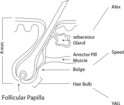 titanium laser machine
