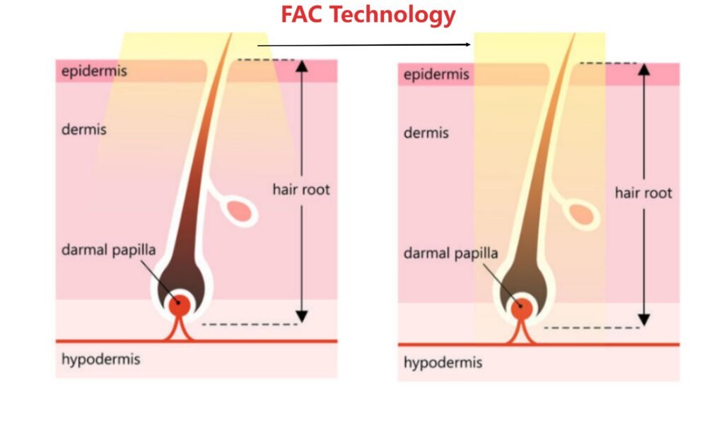 titanium laser machine