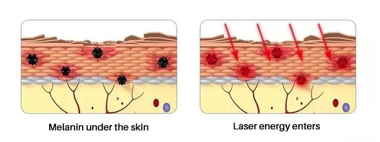 picosecond laser machine